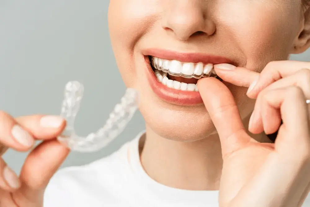 Ortodoncia invisible Una revolución en la estética dental