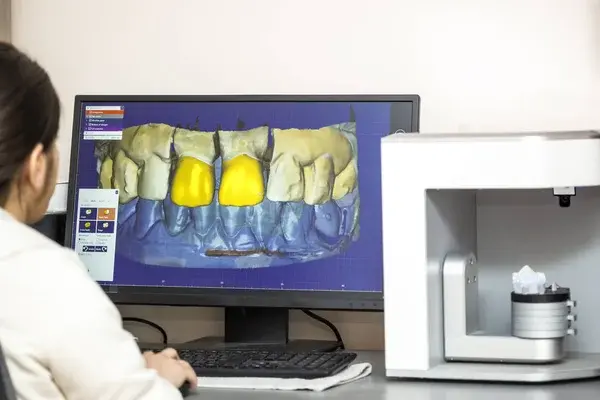 Principales avances en la tecnología dental: scanner