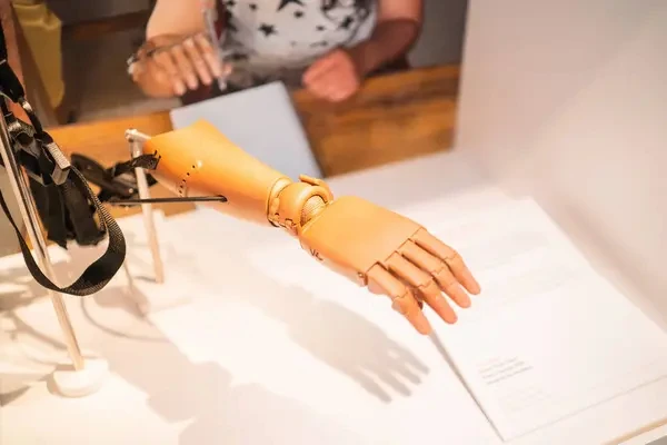 Impresión 3D de una prótesis personalizada
