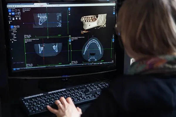 Especialista dental haciendo uso de la impresión 3D en la salud