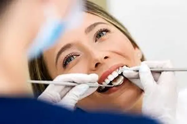 Qué es la estética dental y por qué es importante