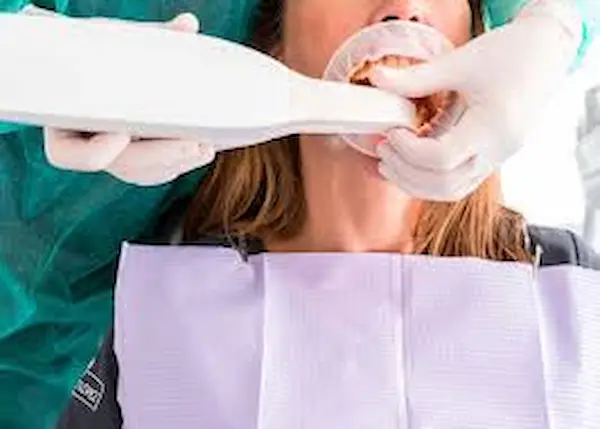 Cómo funciona el escáner intraoral