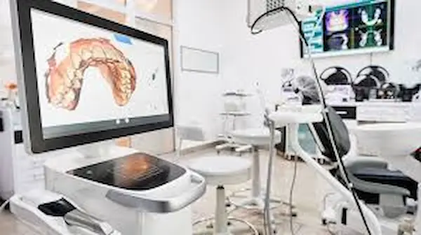 Cuáles son los beneficios de un escáner intraoral