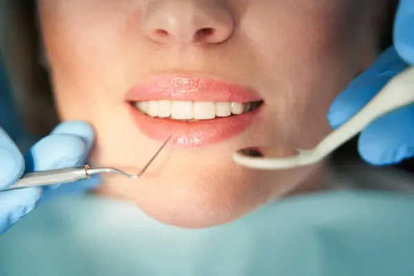 Cada cuánto tiempo se recomienda la profilaxis dental