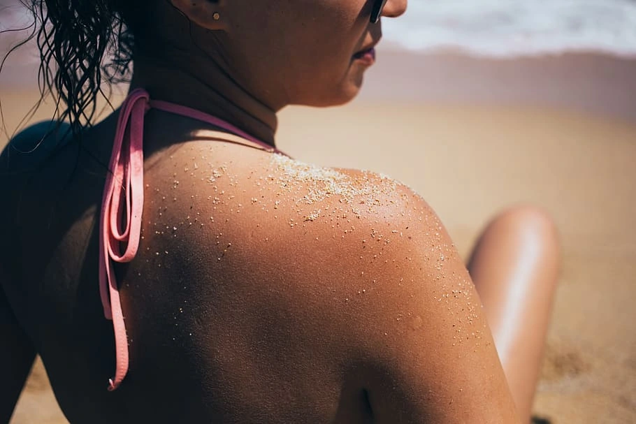 Como cuidar la piel en el verano luego de una quemadura