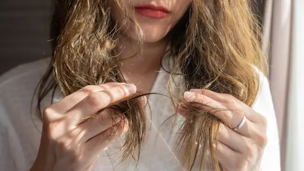 que es el frizz y por que aparece