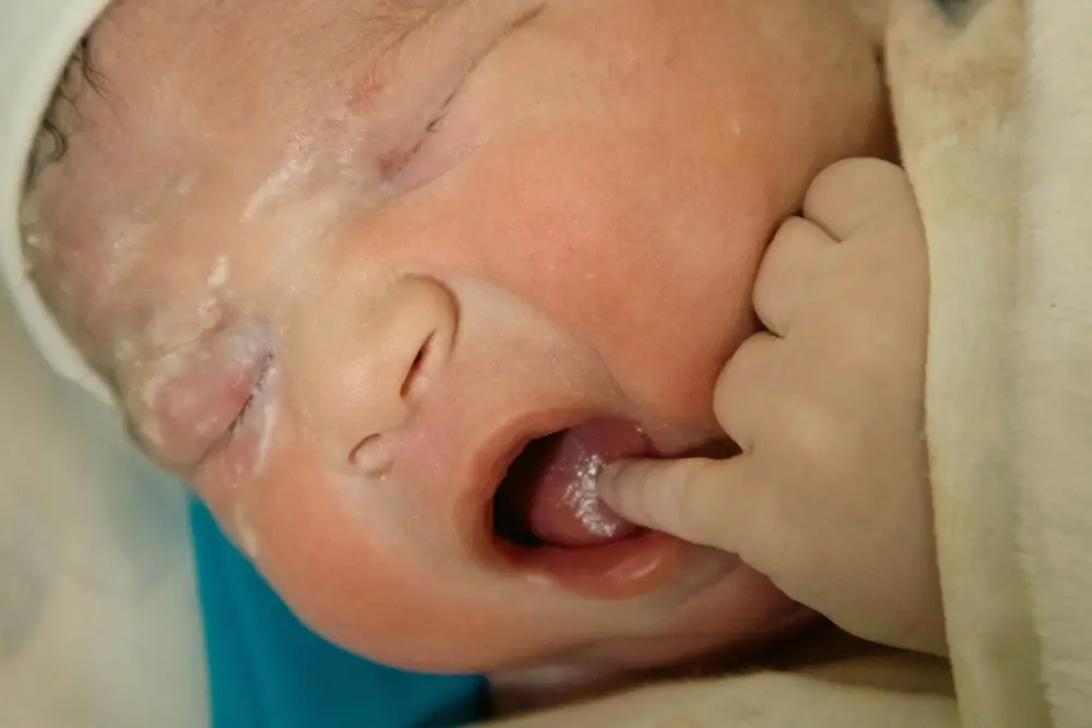 Causas más comunes de la piel atópica en bebés
