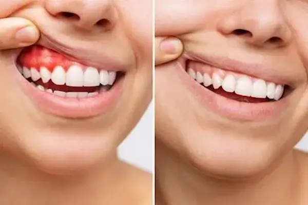 Sonrisa saludable gracias al cuidado dental integral