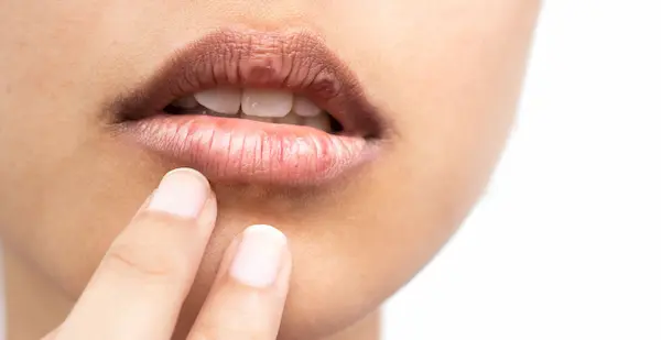 Cuáles son las 10 causas más frecuentes