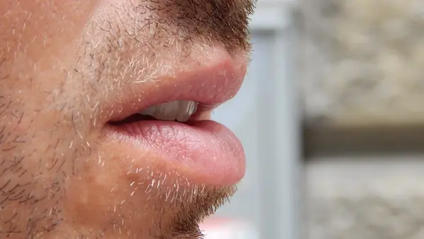 Por qué tengo la boca seca aunque tomo agua