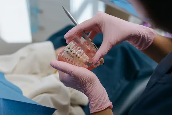 mejores especialistas en endodoncia en Lima